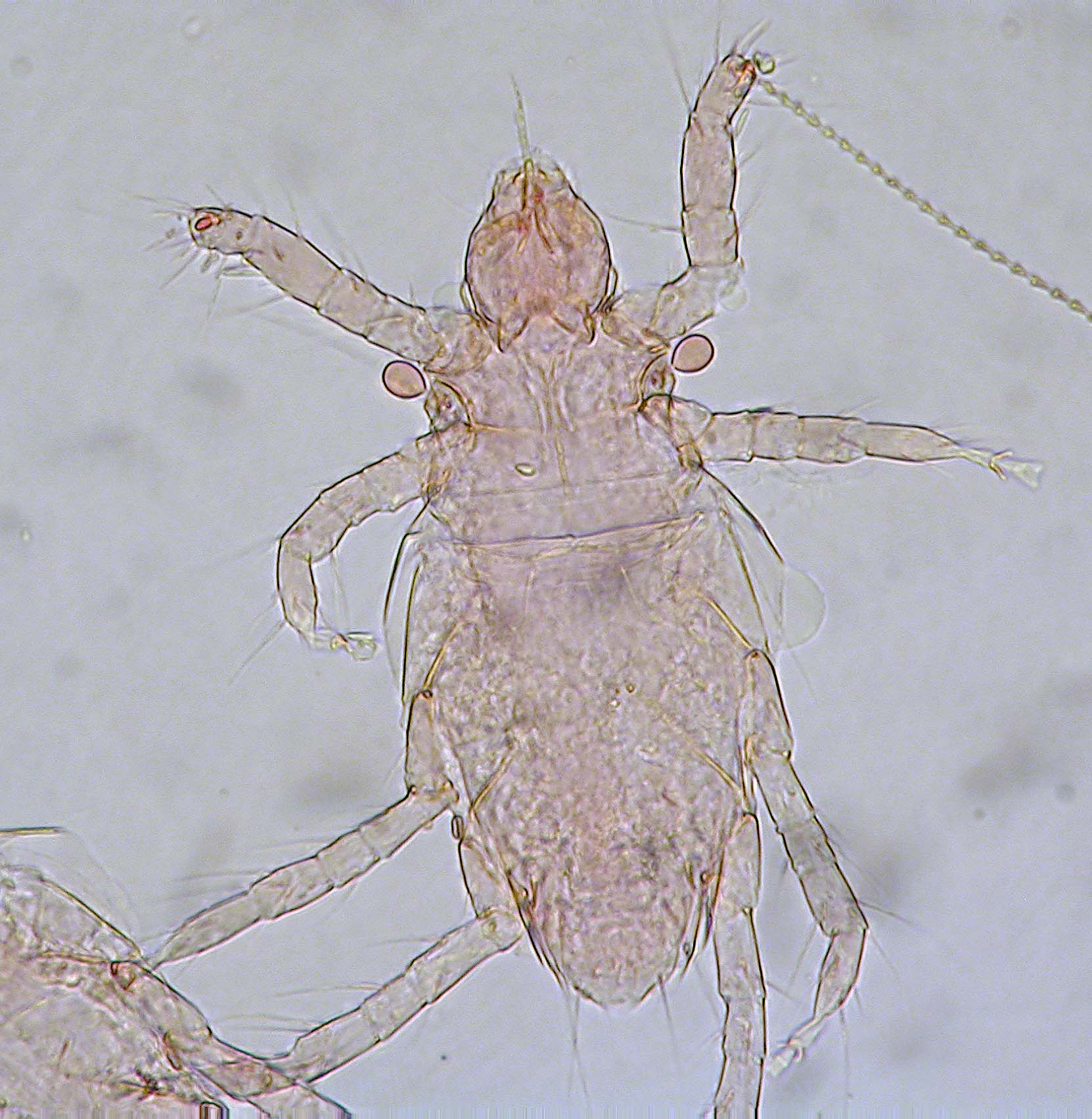 Pyemotes vu au microscope